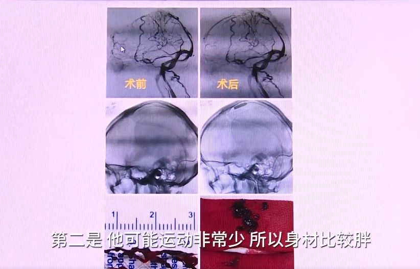 之小伙伴们一定要健康饮食少喝含糖饮料多运动锻炼,定期体检警惕糖尿