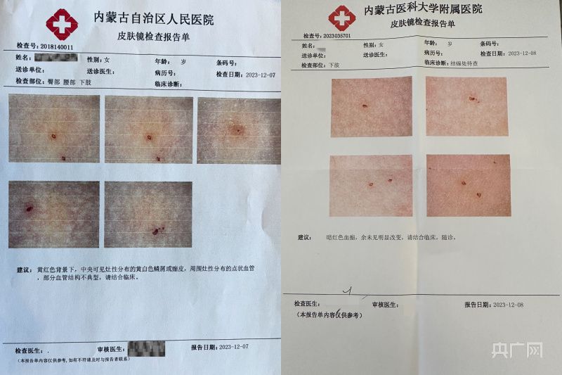 新闻频道>法治>正文医院出具的检查报告单(央广网见习记者 刘晓祺 摄)