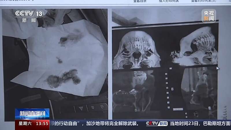 半岛官方网站雪道上发生“追尾”等事故 责任应当如何划分？(图6)